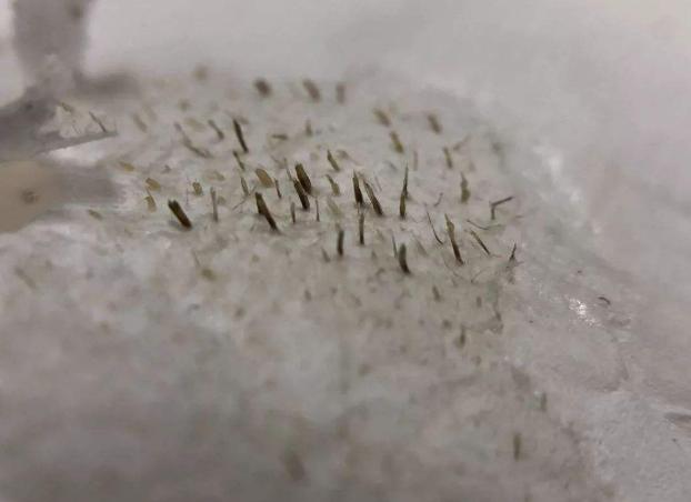 这两物是黑头收割机，揉一揉，搓一搓，黑头不见啦，才几块钱