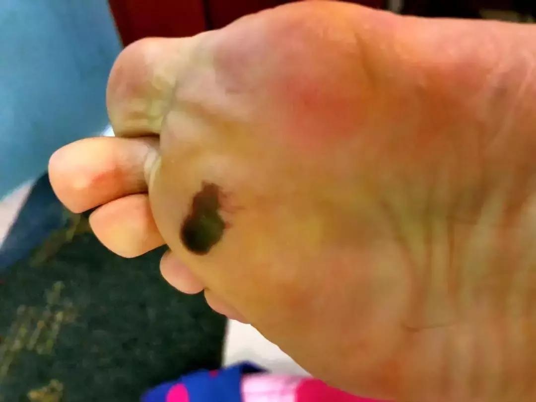 马拉松跑步袜子,跑马拉松能不能穿两双袜子