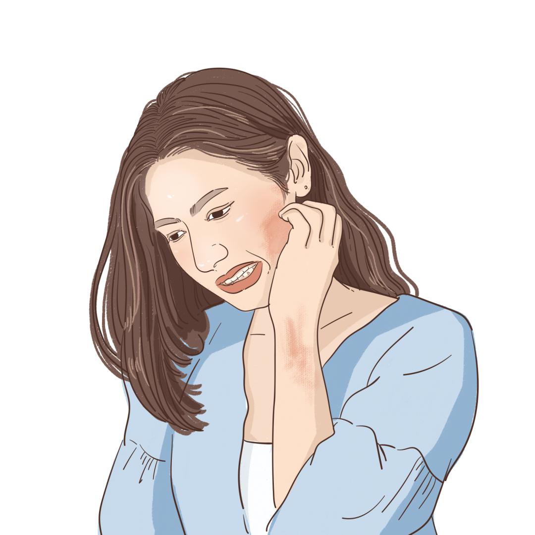 春季皮肤过敏吃什么抗过敏药,春季易过敏教你几个抗敏妙招