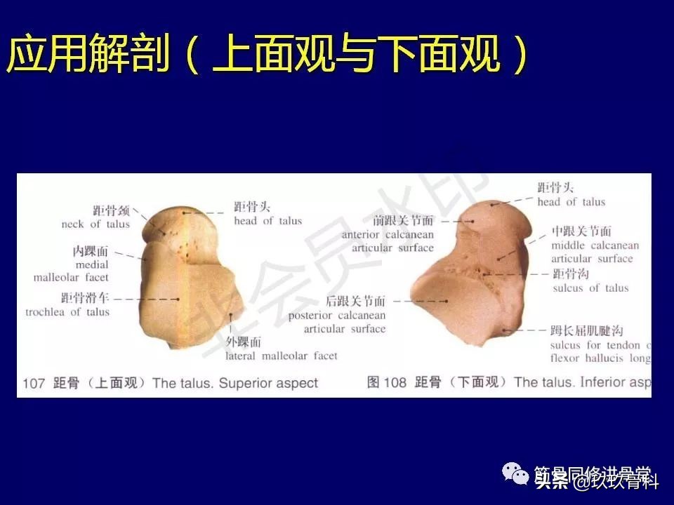 距骨骨折后遗症,距骨骨折怎么办