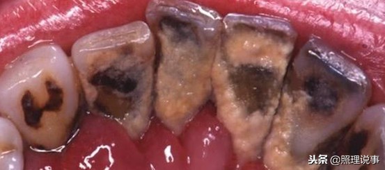 韩国的烟民,韩国烟民