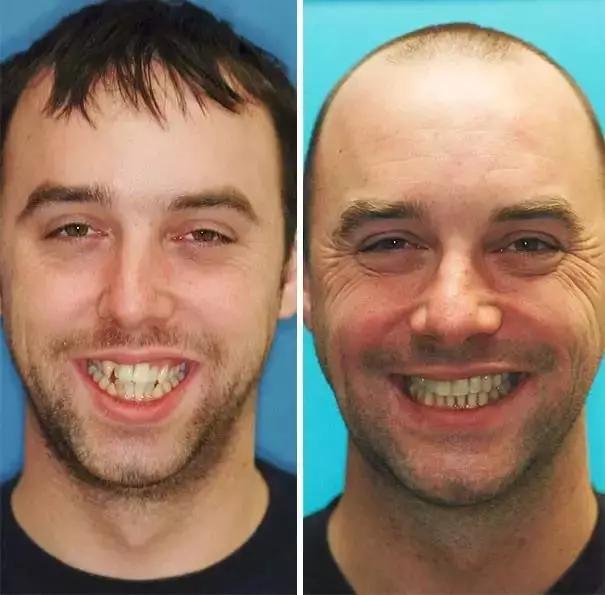 澶栧浗浜烘暣鐗欐晥鏋滃浘,闆呮偊榻跨绉嶇墮