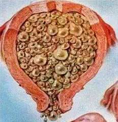 孕妇绝对不能坐在葡萄树下？坐葡萄树下会得葡萄胎？