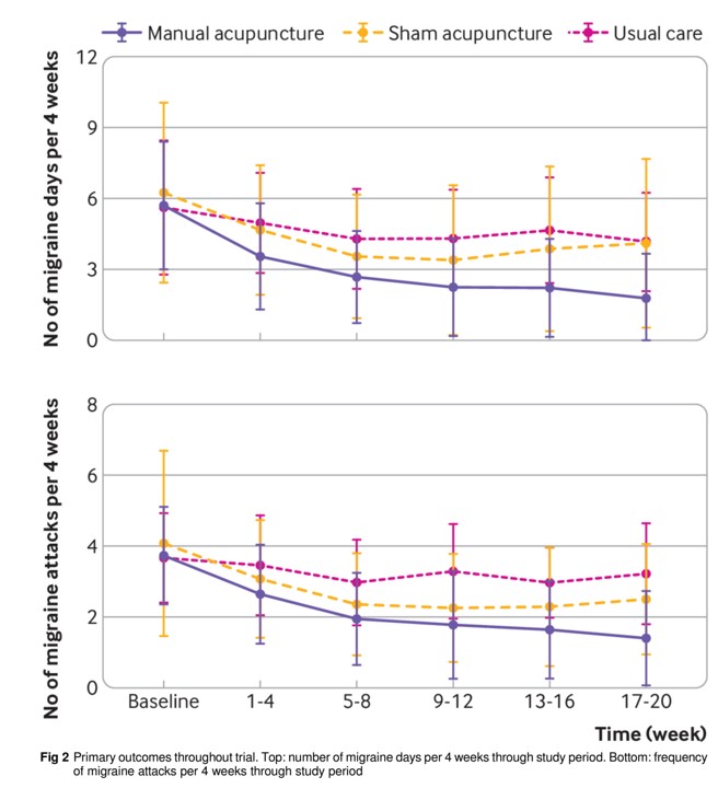 华科学者在顶级期刊BMJ发表论文:中医手针缓解偏头痛