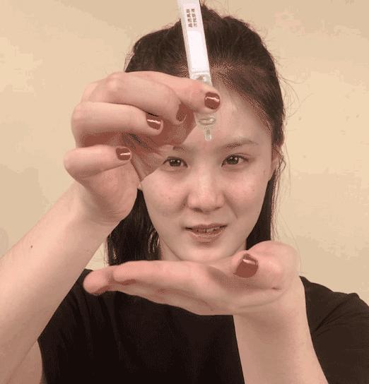 微整的真实效果,微整蜕变过程