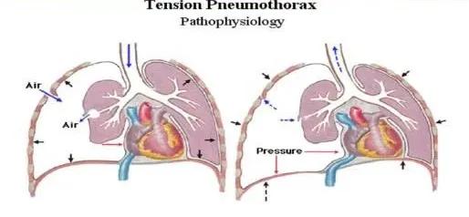 分秒必争急救,分秒必争生命救援