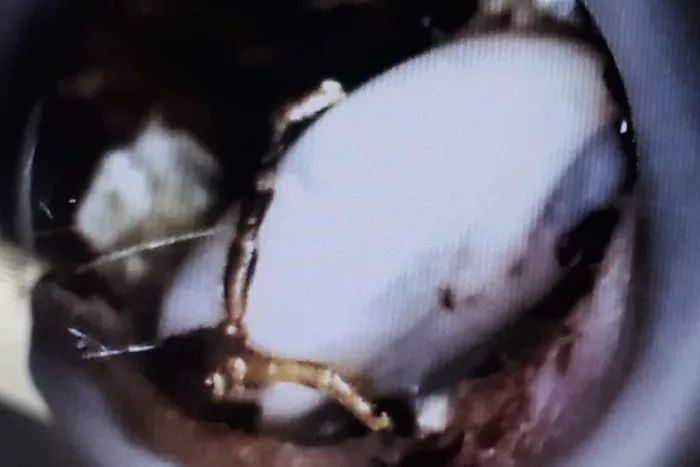 马桶里的蛇是真是假,马桶里的蜈蚣虫