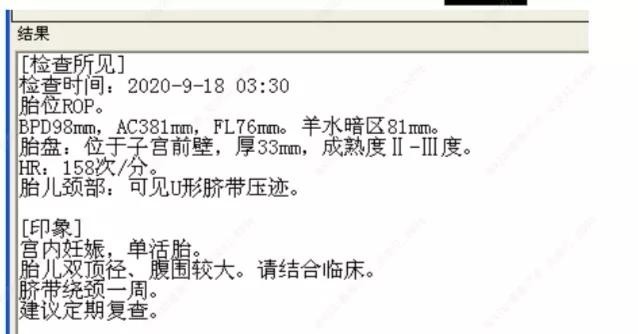 准妈妈如何对“巨大儿”说不？