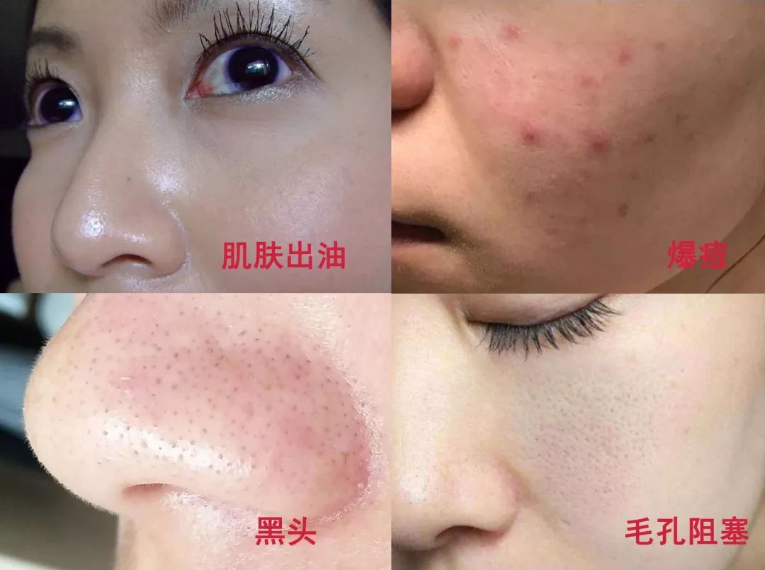 深度清洁脸部面膜,真正有效的清洁面膜