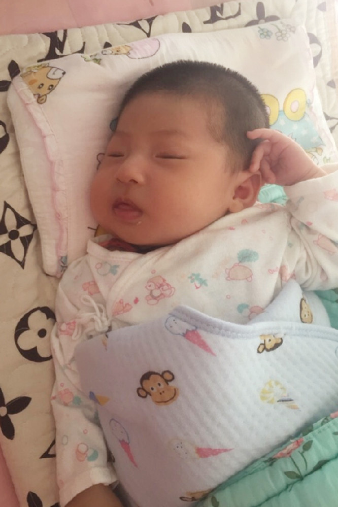 宝宝睡偏头了怎么办还能纠正吗,大月龄宝宝偏头睡觉如何矫正