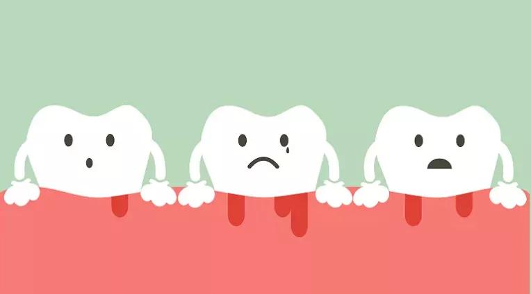 牙龈炎一般是配药治吗,牙龈炎需要吃去火药吗