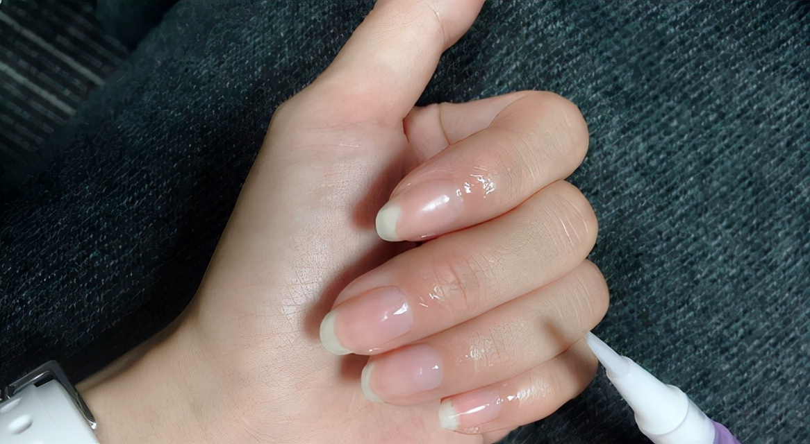 手上起倒刺缺乏什么维生素,手上倒刺最简单的去除方法