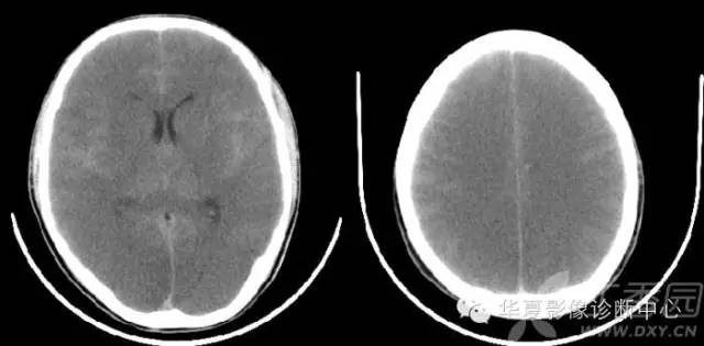 神经系统解剖及定位诊断视频,神经系统影像解析