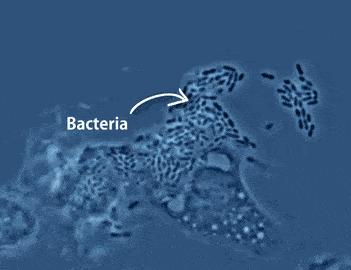 阿奇霉素是停3天还是停4天,用阿奇霉素多长时间见效
