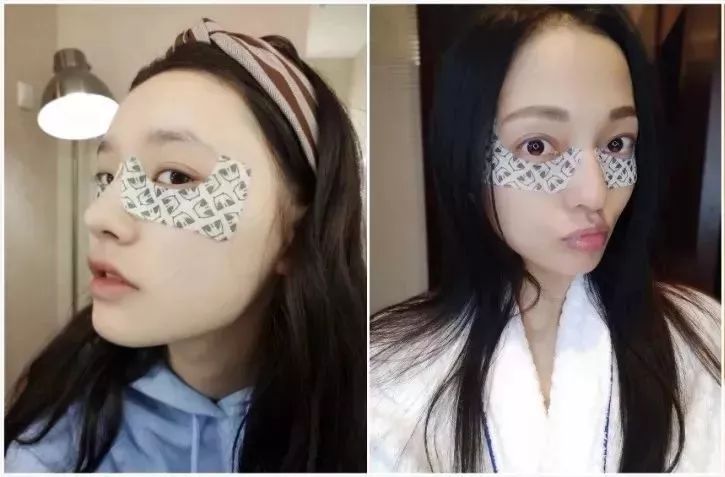 林允张韶涵面膜,ins百万时尚博主