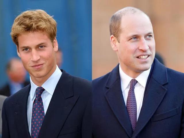 所以秃头的标准是发际线高≥7cm？头秃代表不再是中老年独扛大旗，90后、00后也在积极踊跃加入组织