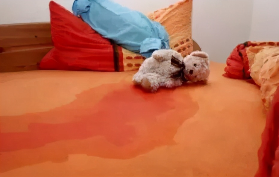 隐性脊柱裂导致尿床怎么办,十二岁隐性脊柱裂尿床