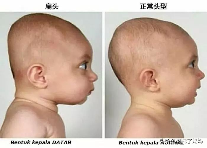 孩子有这三个习惯会越来越丑,越长越丑的几个习惯