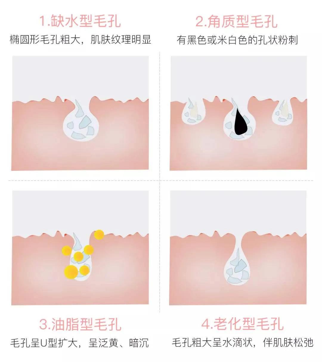 毛孔清洁小常识大全,毛孔深度清洁的步骤