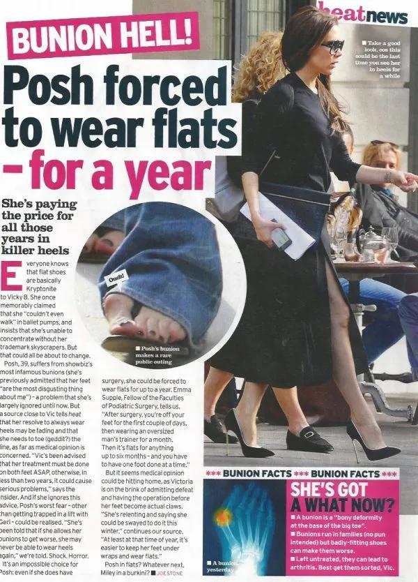 女明星的小脚趾太难了，很多走红毯的时候就被丢了