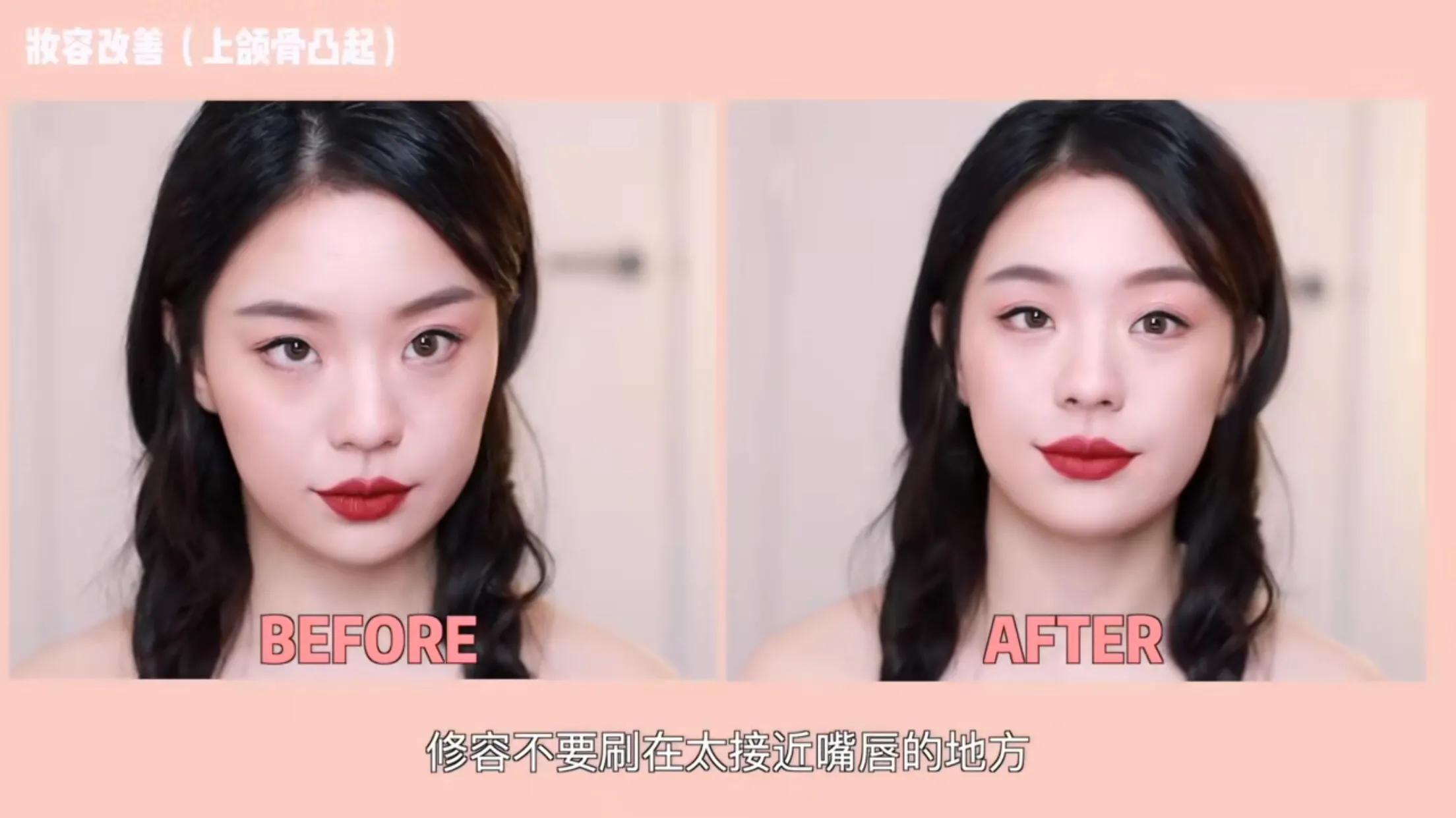 侧颜凸嘴怎么修,让侧脸变好看的方法