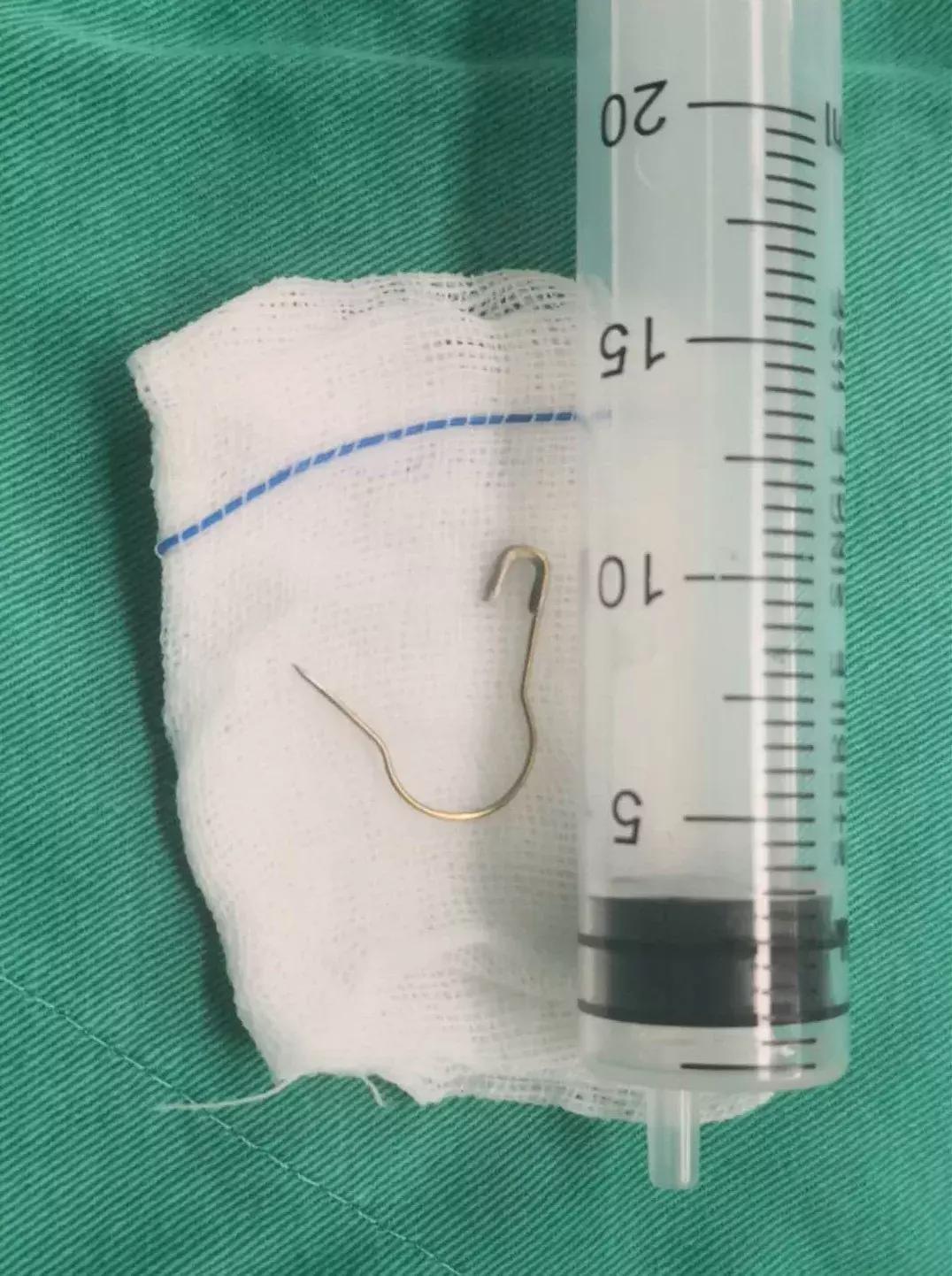 宝宝误食别针怎么办,宝宝吞别针