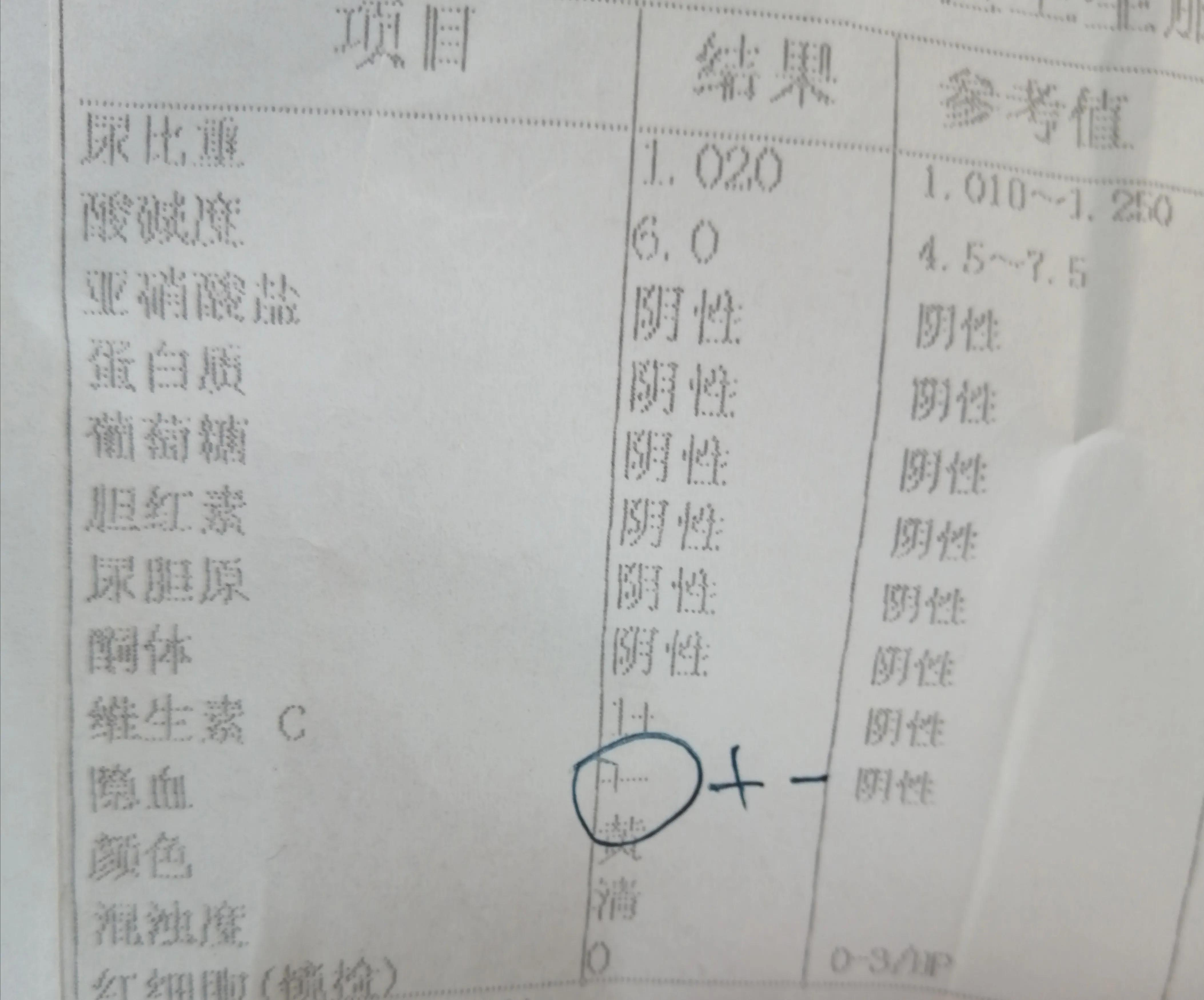 儿童尿隐血1+要不要紧,儿童尿隐血1+要紧吗