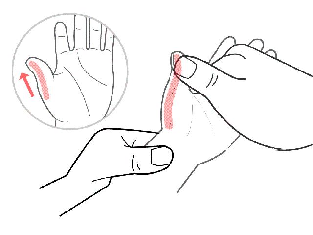 宝宝积食发烧38.5用不用喝退烧药,怎么判断小孩是积食引起的发烧