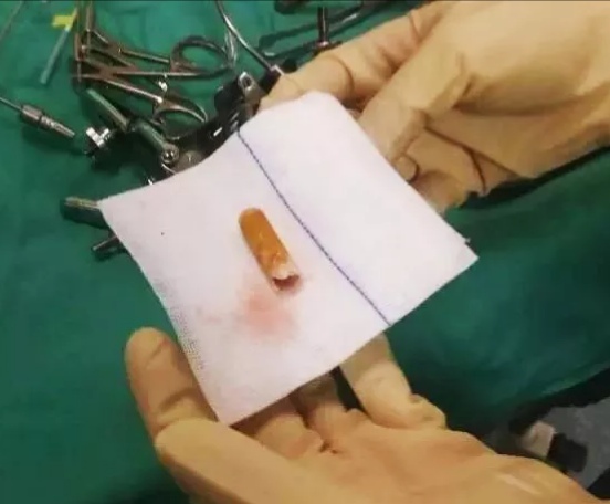 濂崇浣撳唴涓嶆槑鍘熷洜鍑鸿,濂崇浣撳唴鑾悕澶ч噺鍑鸿