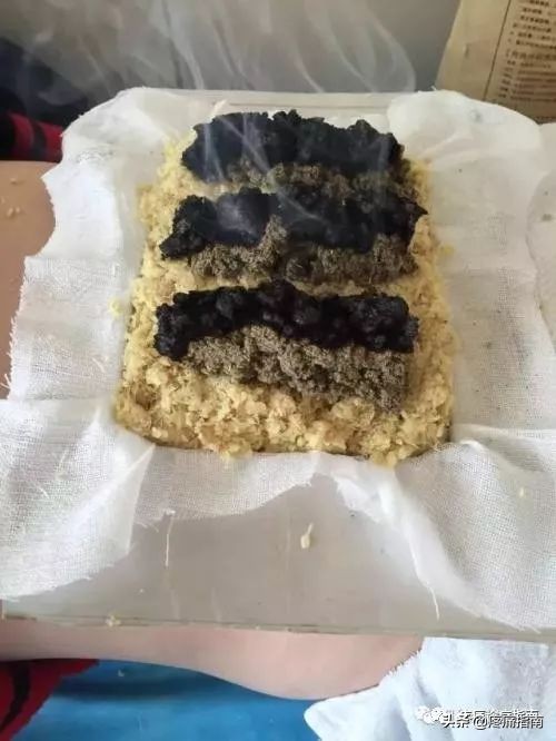 脊原性疾病,脊源性疾病怎么治