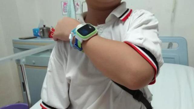 女子掰手腕把手臂掰断了,掰手腕为什么会掰断手臂