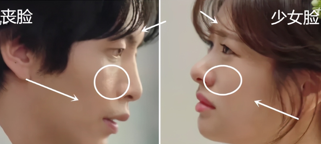 面部显老憔悴怎么办,显老显丧的面颊凹陷应该如何改善