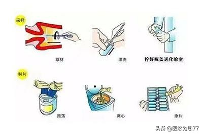 女性做宫颈癌筛查需要多少钱,65后需要做宫颈癌筛查吗