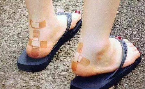 新鞋夹脚后怎么处理最好,新鞋夹脚怎么办小窍门