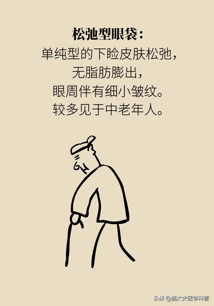 有眼袋怎么办五种去眼袋秘方,眼袋重最简单的去眼袋的方法