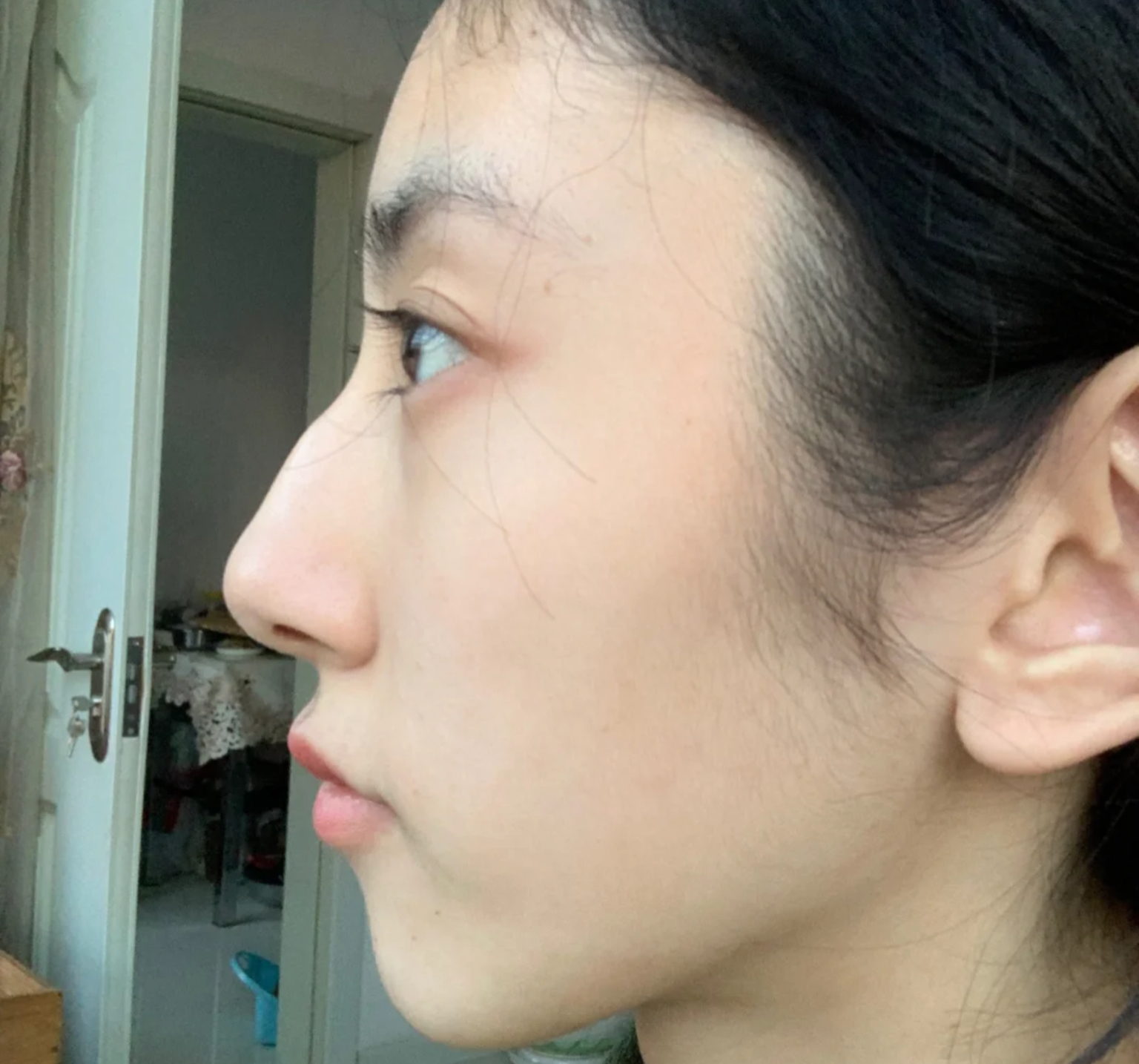 塌鼻梁蒜头鼻就一定丑吗,高鼻梁的蒜头鼻还能拯救吗