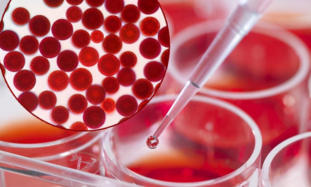 坤德国际爱尔发虾青素,坤德虾青素