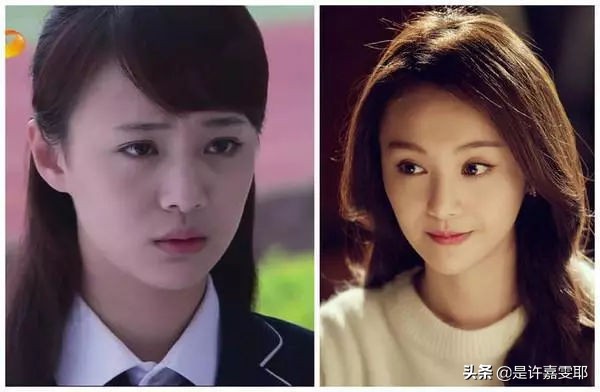 关于除皱针你知道多少,关于微整形你想知道的都在这里