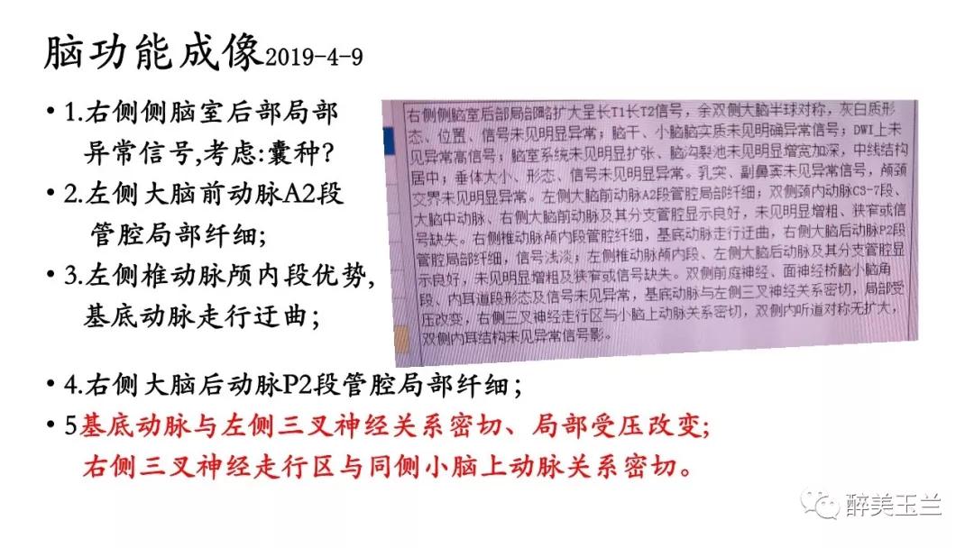 病例分享丨三叉神经节微球囊压迫术的麻醉管理