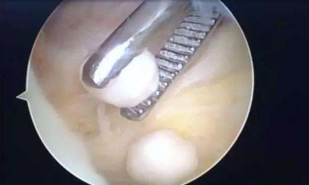 犬分离性软骨病,犬的主要疾病有哪些