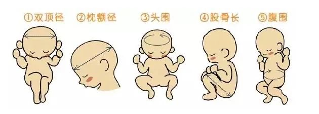 孕期一共做几次b超检查,孕期需要做几次b超检查