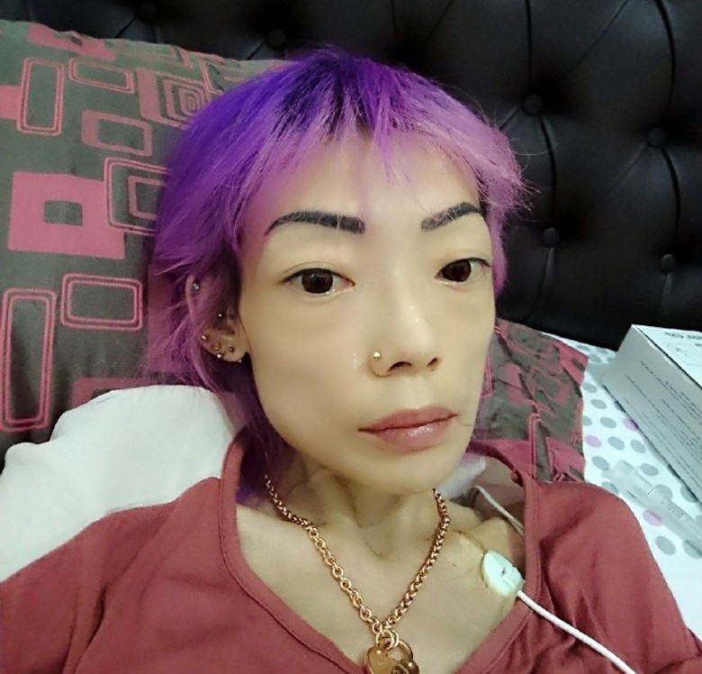 伍智恒患病前后对比图,伍智恒减肥前后照片