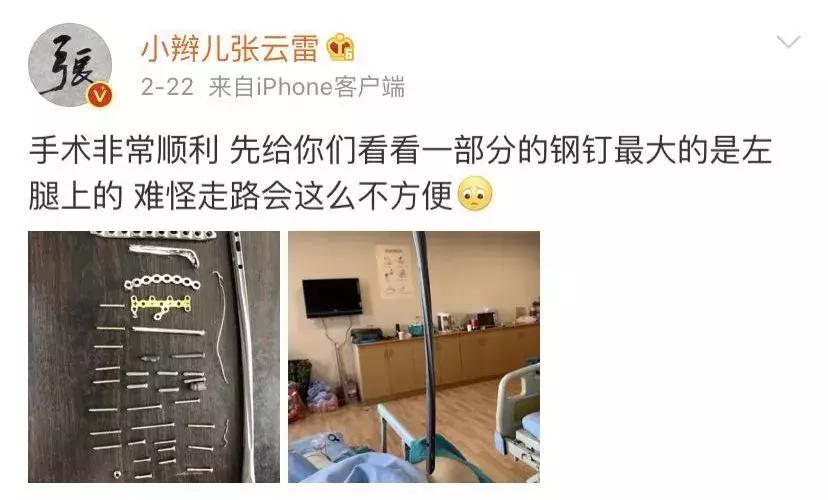 张云雷“渡劫”归来：手术取出全身钢钉，恢复不到一月便急回舞台