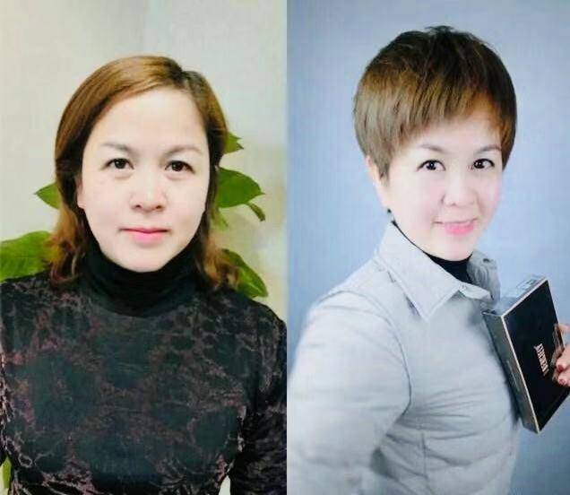 40岁的女人怎么预防衰老,40岁女人如何保养才能延缓衰老