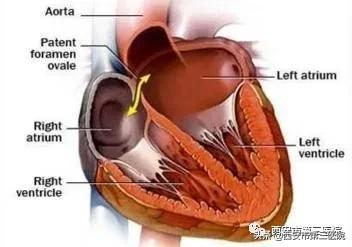 小心眼小妙招,改掉小心眼的小妙招