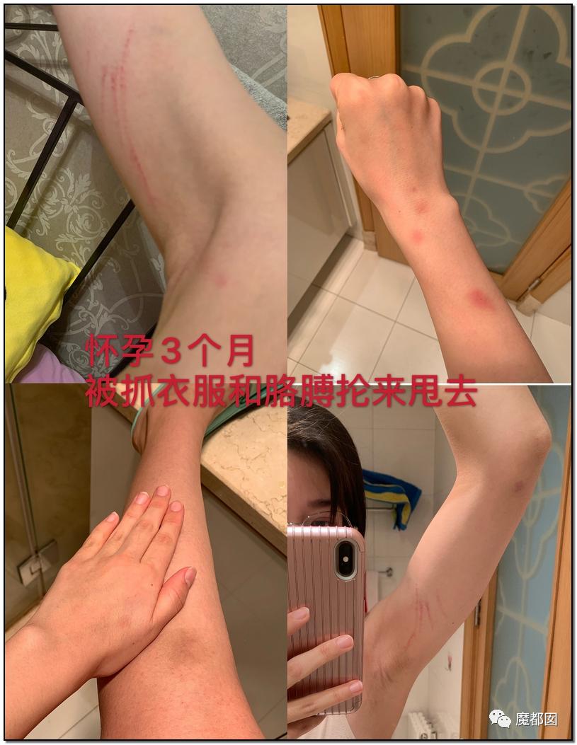 短跑名将张培萌家暴事件,短跑名将张培萌被控家暴