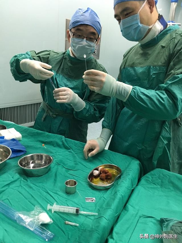 三叉神经痛微创治疗方法,超微创定向修复三叉神经