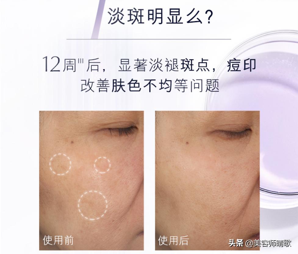 淡斑小白瓶精华二代,小白瓶美白淡斑护肤品推荐