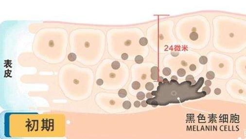 煮出来的米饭更加健康营养美味,鸡蛋放在米饭里煮比较有营养吗