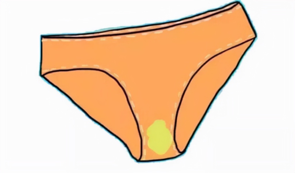 女性裤子上有黄色的东西正常吗,内裤上有黄红的分泌物是怎么回事